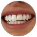 Step 4